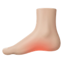 Foot with highlighted arch